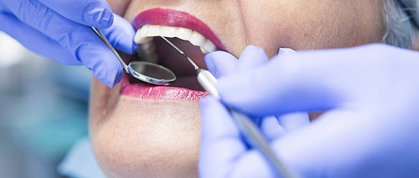 Best Dentist for Tooth Abscess  in Lake Como, NJ